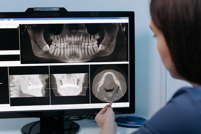 Orthodontics treatment options displayed at Dentistry on Lawrence dentist in Kitchener