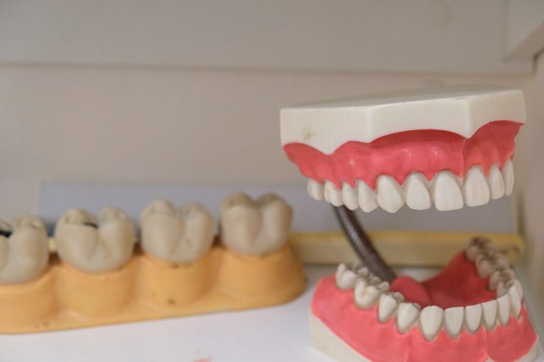 Orthodontics treatment planning software at Dentistry on Lawrence dentist in Kitchener dentures