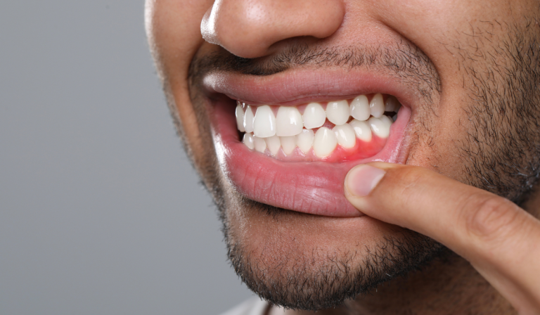 Dentist in Kitchener performing periodontal therapy at Dentistry on Lawrence